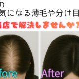 冬の「トップがつぶれる」お悩みに｜地毛に結ぶ増毛で自然なふんわり感へ❄️